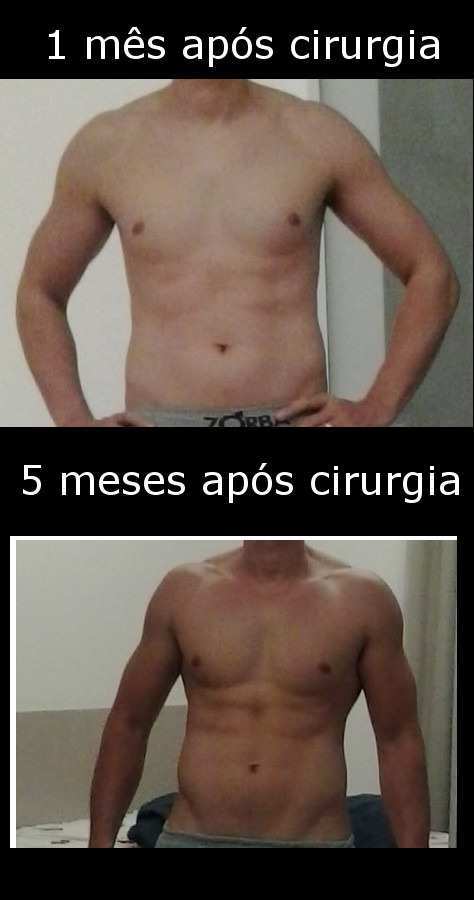 comparacao_cirurgia2013.jpg